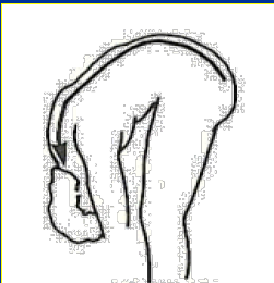 <p>What Movement is occurring?</p>