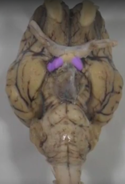 what part of the brain is this?
