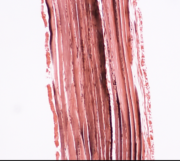 <p>What type of muscle tissue is this?</p>