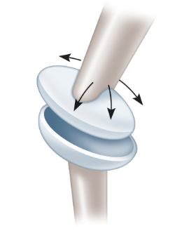 What type of synovial joint is listed in the picture?