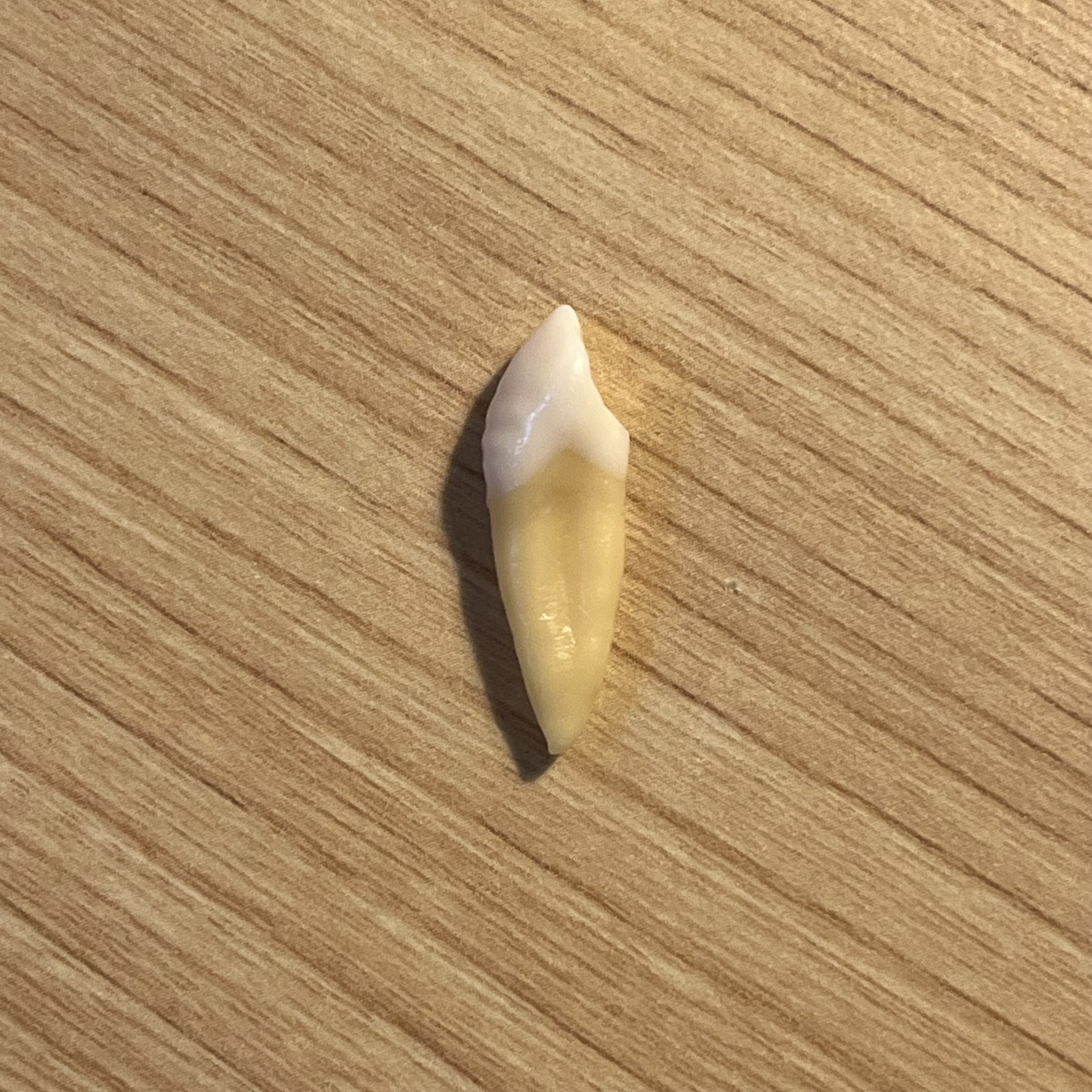 <p>What tooth is this (with view)?</p>