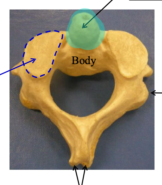 <p>Name the highlighted structure.</p>