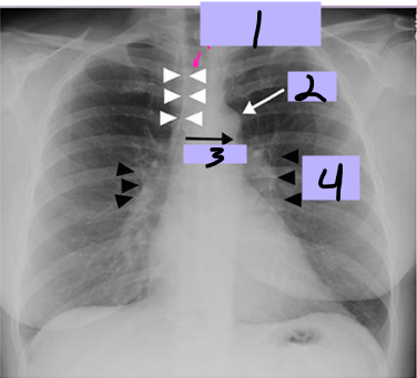 <p>#1</p>