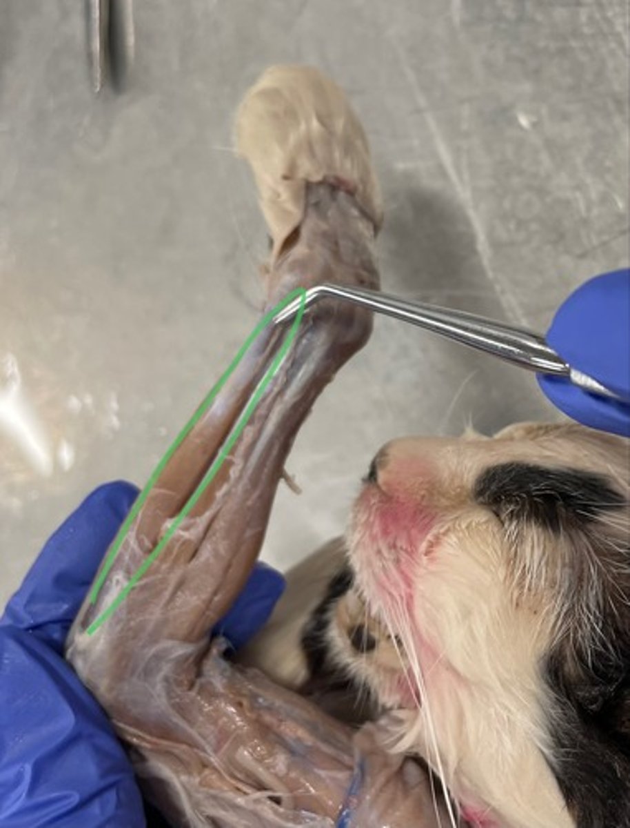 <p>O: lateral epicondyle of humerus</p><p>I: base of metacarpal V</p><p>A: extend wrist; adduct wrist</p>