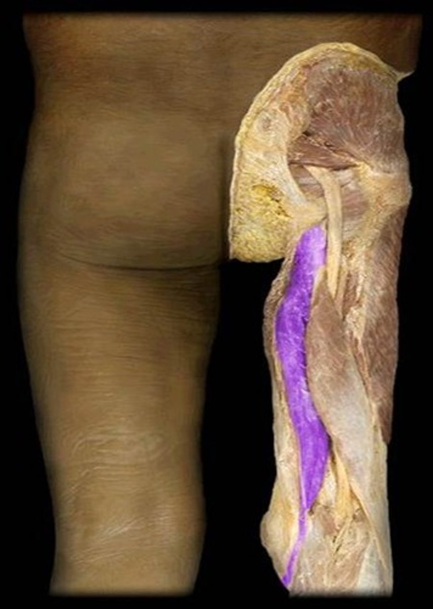 <p>What is the name of this muscle, highlighted in purple?</p>