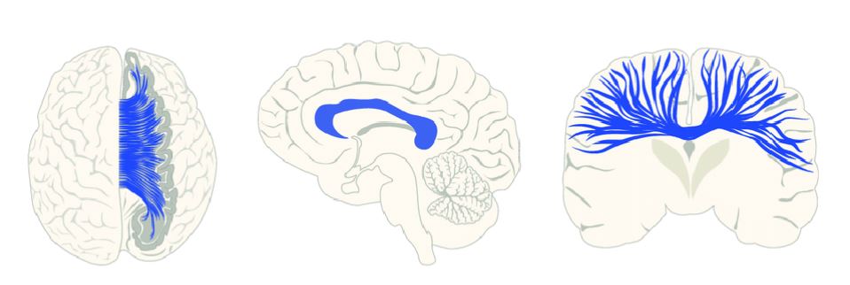 <p><span style="font-family: Arial, sans-serif"><mark data-color="yellow">nerve fibers that </mark></span><strong><em><span style="font-family: Arial, sans-serif"><mark data-color="yellow">run laterally from one hemisphere to another</mark></span></em></strong></p><ul><li><p><span style="font-family: Arial, sans-serif">responsible for <mark data-color="blue">maintaining </mark></span><strong><em><span style="font-family: Arial, sans-serif"><mark data-color="blue">inter-hemispherical functions</mark></span></em></strong></p></li></ul>