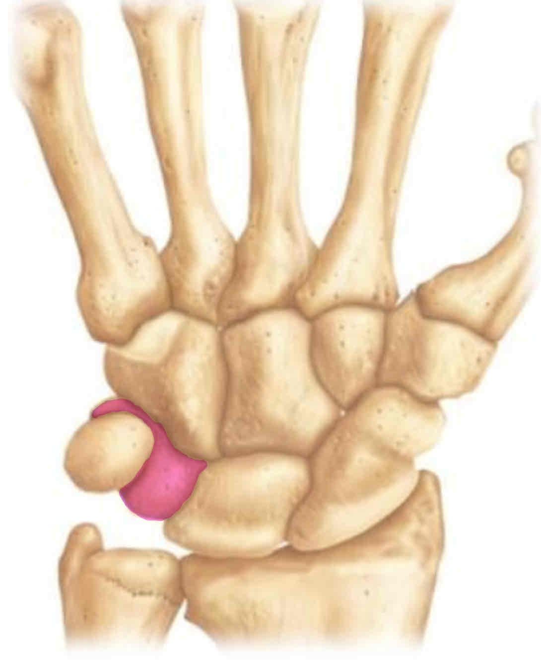term image