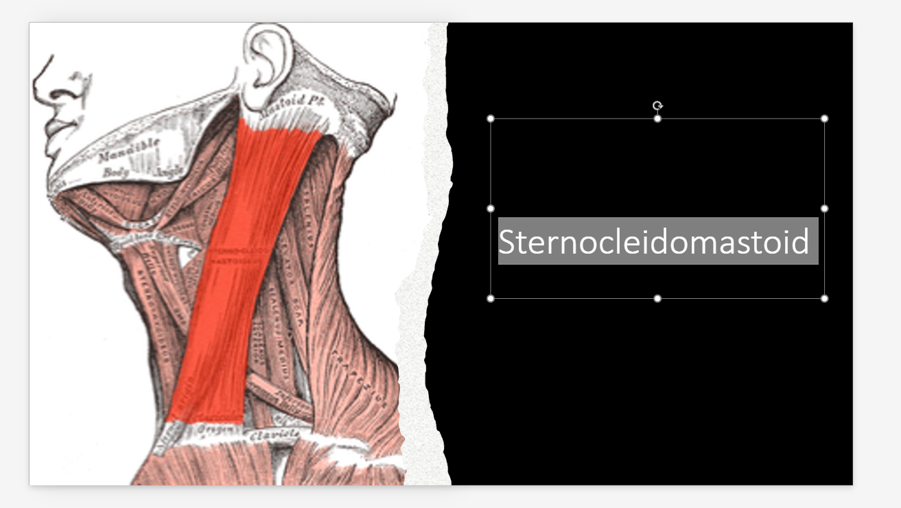 <p>Neck</p>