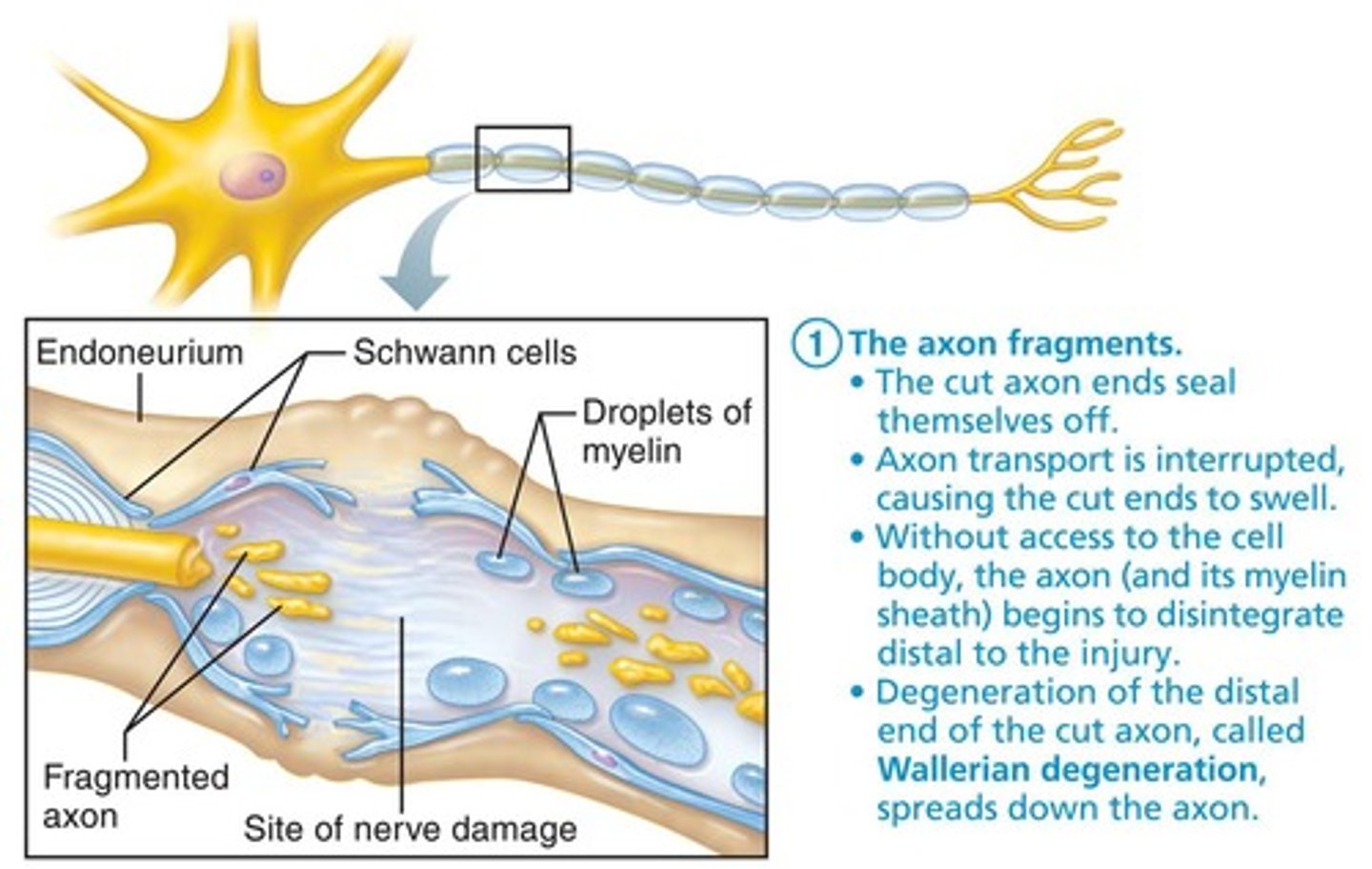 <p>axon fragments and myelin sheaths distal to injury degenerate; degeneration spreads down axon</p>