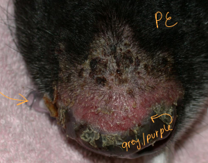 <ul><li><p>Rare</p></li><li><p><span style="color: rgb(136, 136, 136);"><strong>Et: </strong></span><span style="color: red;"><strong><u>Subcorneal pustules: Basal cell damage: DSG 1</u></strong></span></p></li><li><p><span style="color: rgb(136, 136, 136);"><strong>Cs:</strong></span> Pustules, crusts, <strong>depigmentation, erythema</strong>, erosion</p><ul><li><p><u>Face, nose, pinna</u></p></li></ul></li><li><p><span style="color: rgb(136, 136, 136);"><strong>Dt: </strong></span>Microscopy; <strong><u>acantholysis</u></strong> +<strong><u> lichenoid interface dermatitis(pustules &amp; inflammation)</u></strong></p></li><li><p><span style="color: rgb(136, 136, 136);"><strong>Tx:</strong></span><strong> </strong>glucocorticoids (pred, triam, dex)</p><ul><li><p>Others: Azathioprine, Chlorambucil(cats), Cyclosporine, Mycophenolate mofetil, apoquel</p></li></ul></li></ul><p></p>