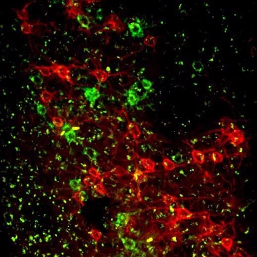 <p>species stained with fluorescent dye and 3D images of thick structures form</p>