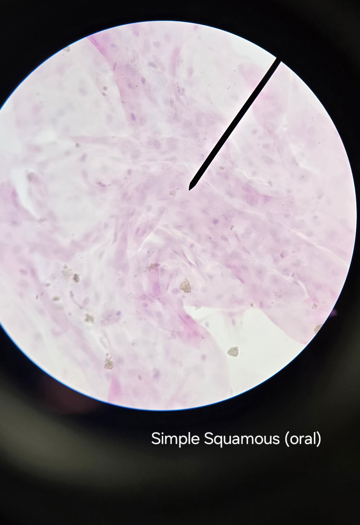 <p>Simple squamous epithelium</p>