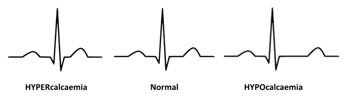 <p>hyper: SHORT QT</p><p>hypo: LONG QT wave</p>