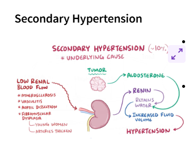 <p>secondary hypertention is caused by underlying conditions</p>