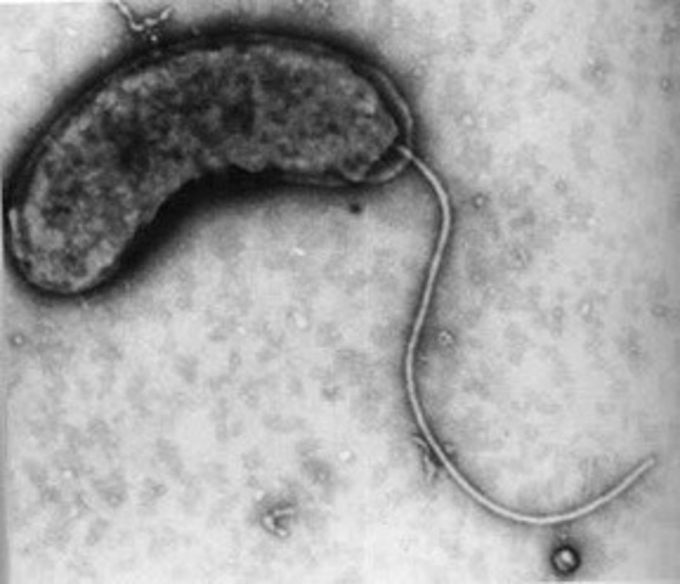 <p>flagellum at end of the cell</p>