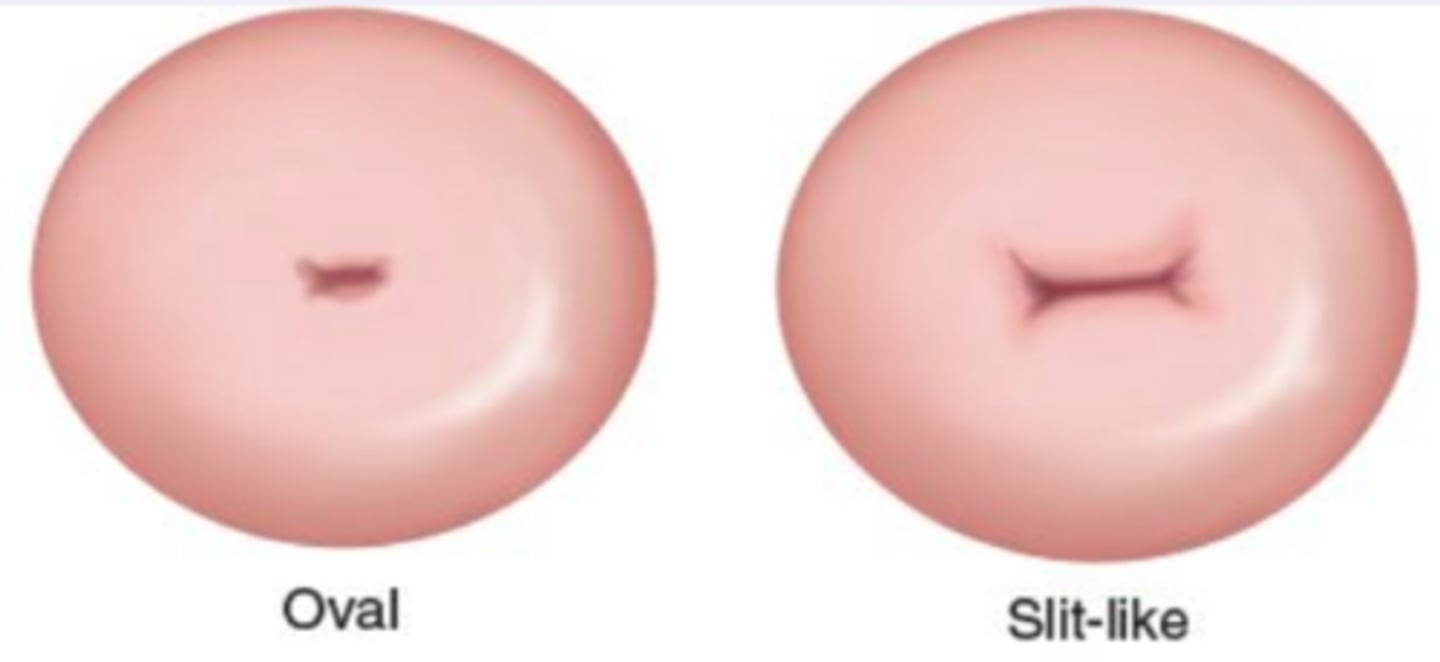<p>oval and slit-like</p>