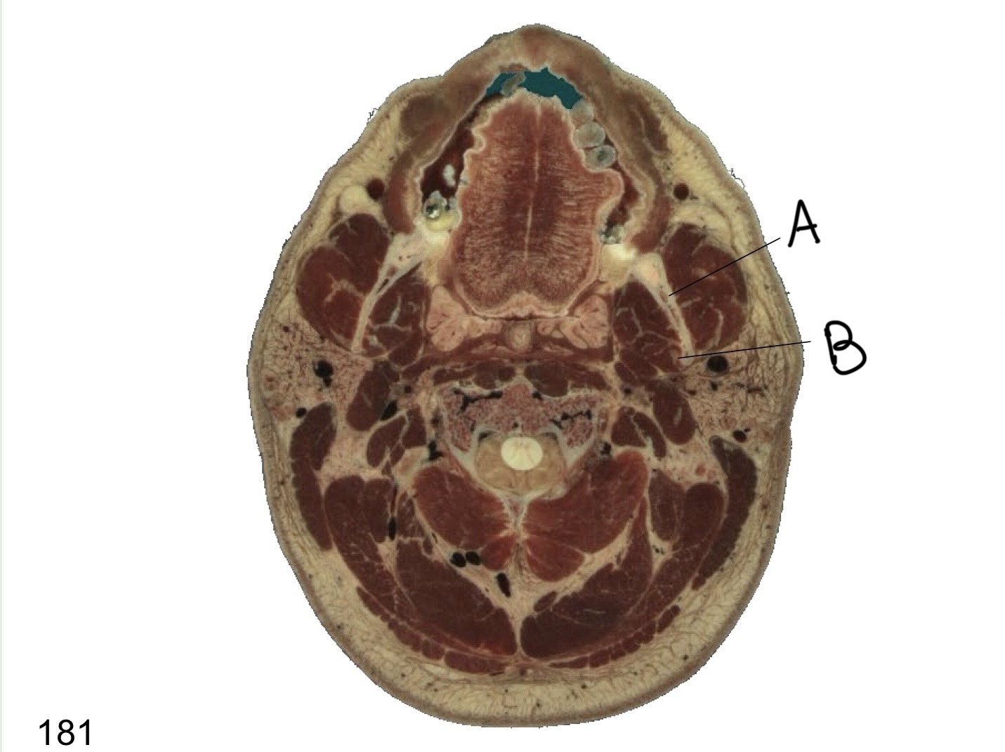 <p>What structure is labeled A?</p>