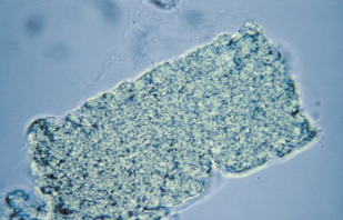 <p>Identify the urine sediment element shown and what perspective it is in</p>