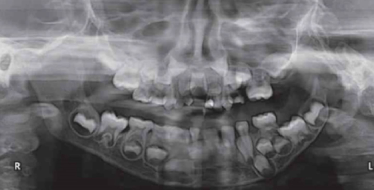 <p>whats the age</p><p>5-6</p><p>7-8</p><p>9-10</p><p>11-12</p>