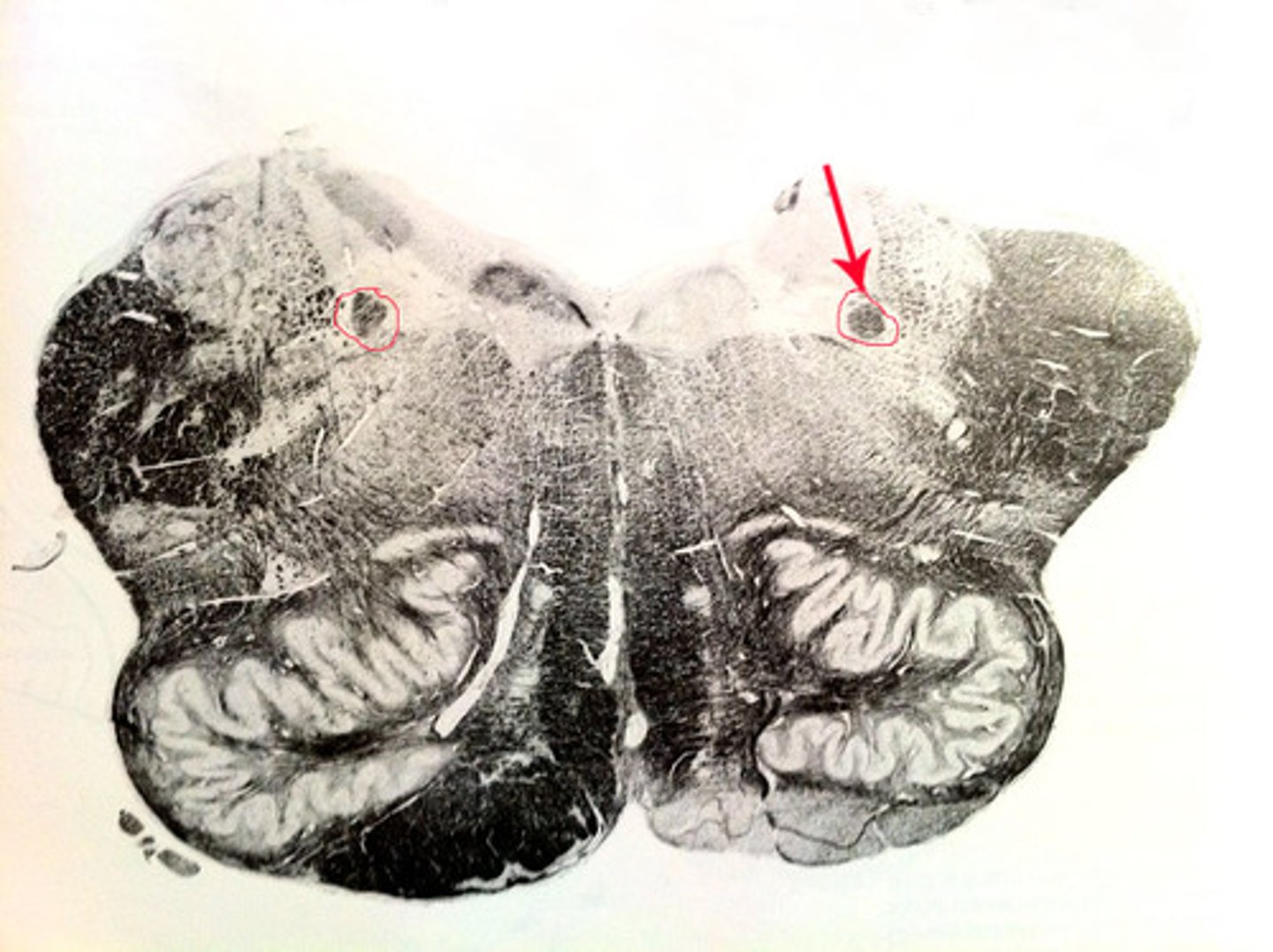 <p>receives and processes sensory information from cardiovascular, respiratory, and gastrointestinal systems</p>