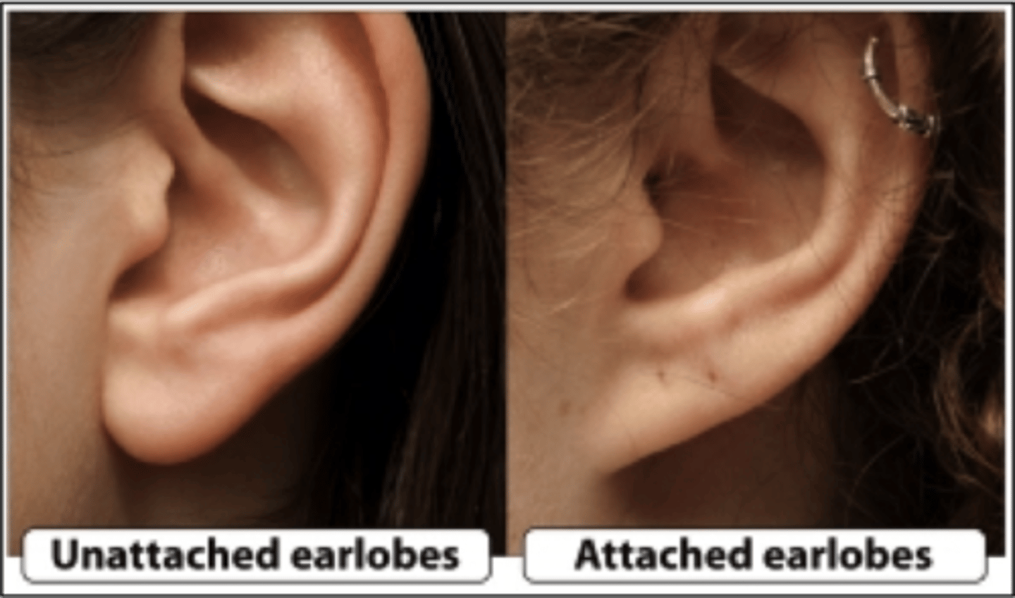 <p>Trait controlled by a single gene (ex: attached or unattached earlobes).</p>