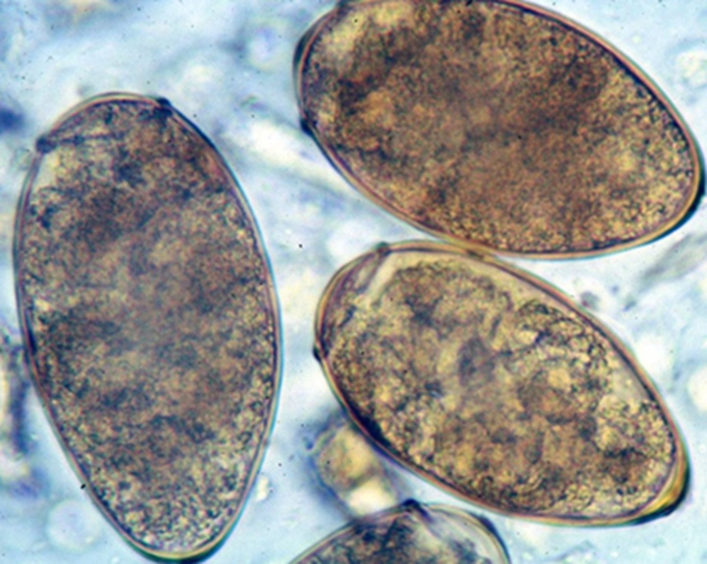 <p>These eggs were found in the sputum of a coughing dog with daily access to a creek in its back yard. They are ~90 x 50 µm. What parasite is producing them?</p>