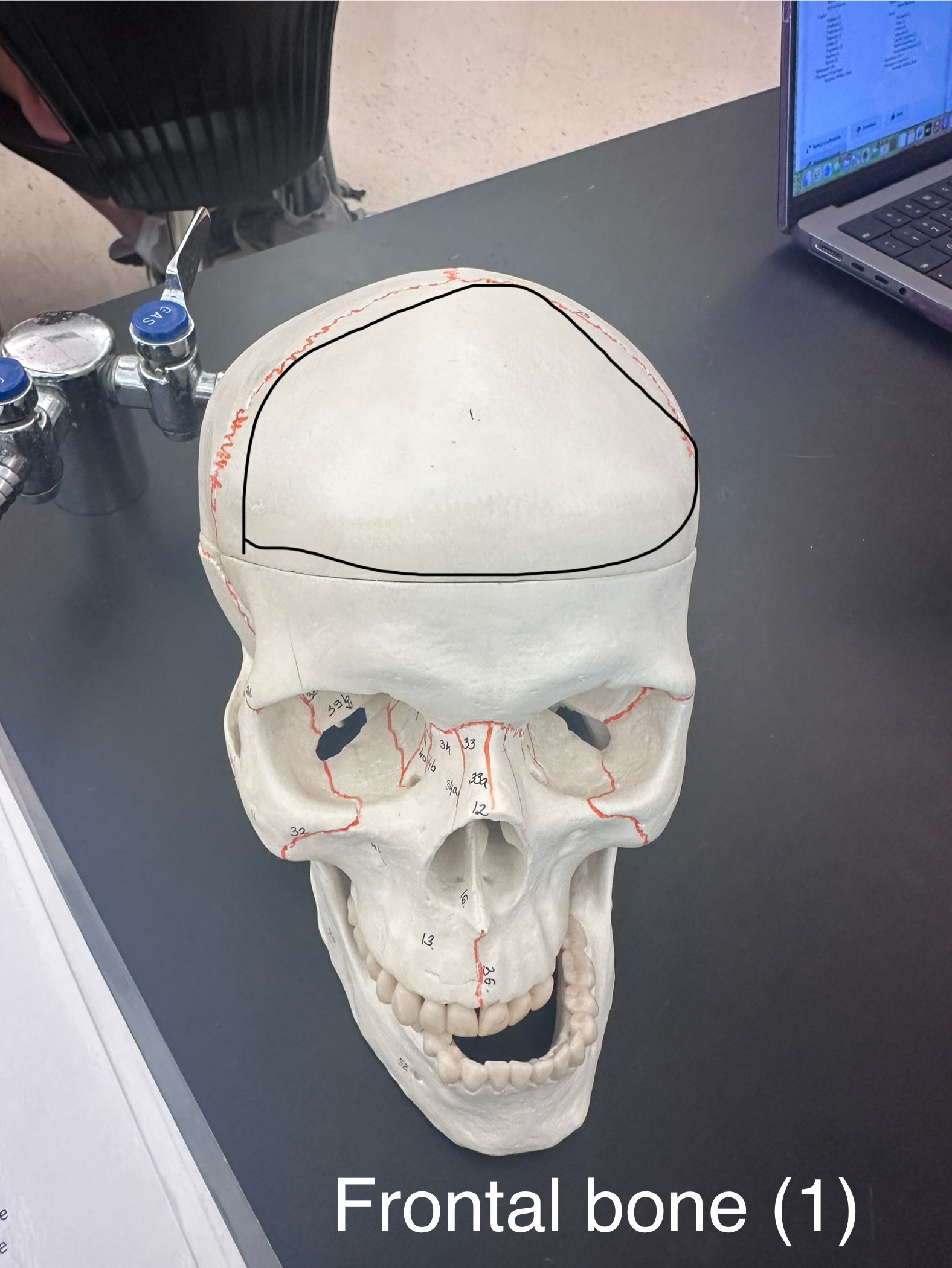 <p>Frontal Bone</p>