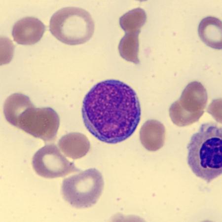 <p>What is this leukocyte?</p>