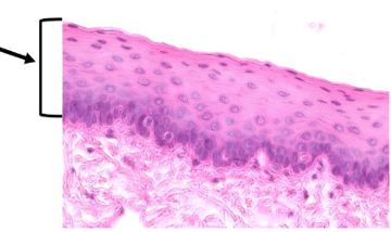 <p>What type of tissue is this? </p>