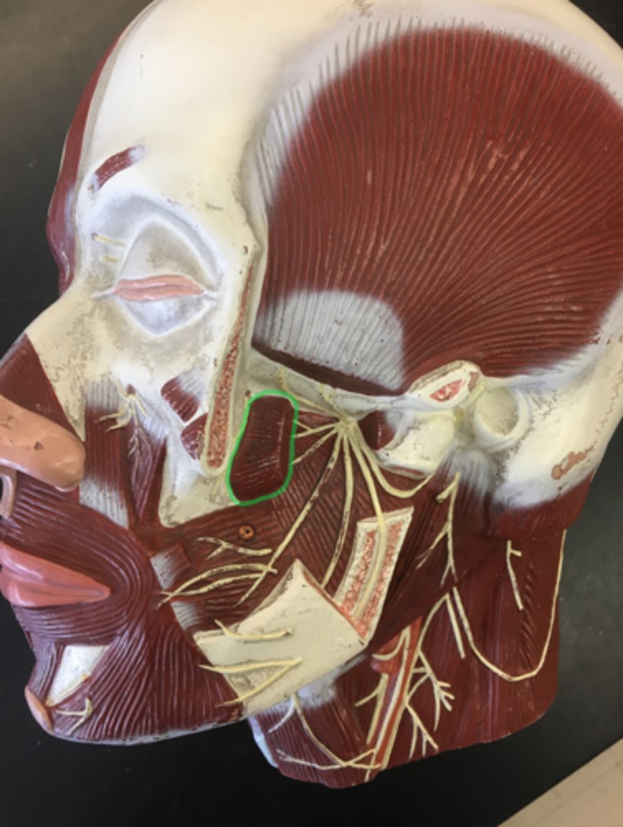 <p>(top) sits, above medial pterygoid, horizontal striations.</p><p>Origin: Pterygoid Process</p><p>Insertion: Ramus of the Mandible</p>
