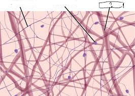 <p>These are FIBERS that <strong>RESIST STRETCH and MAKES THE SKIN MORE TIGHT</strong></p><ul><li><p><strong>PREVENTS SAGGING AND WRINKLES</strong></p><ul><li><p>Losing collagen → more wrinkles around the face and body</p></li></ul></li><li><p>These look <strong>THICK</strong> </p></li></ul><p></p>
