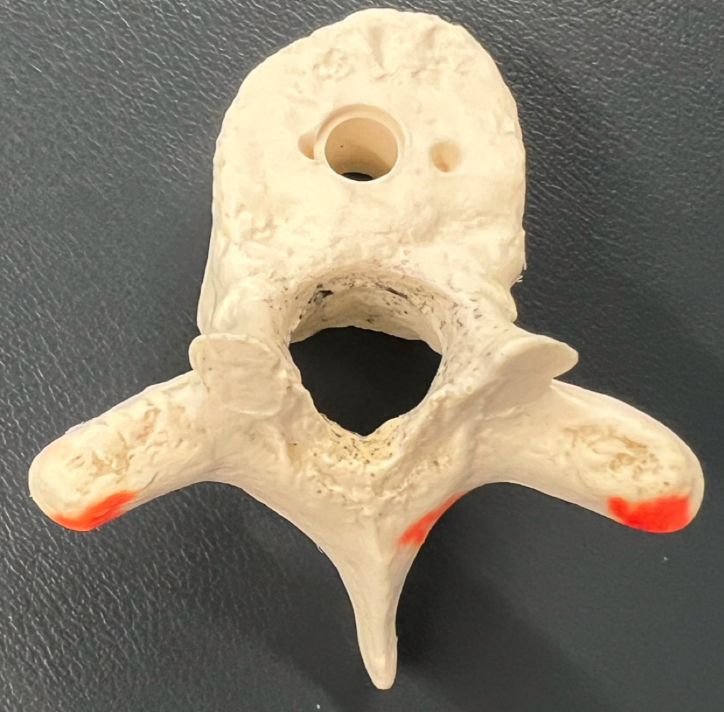 Which group does this vertebrae belong to? 