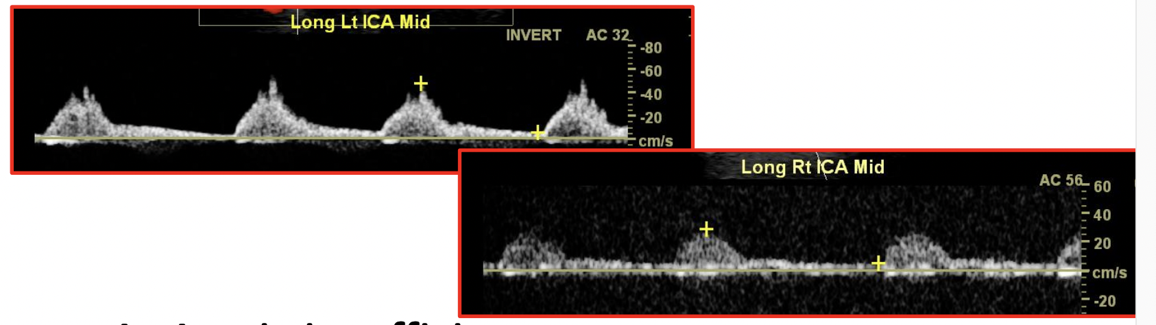 <p>How would you explain this waveform</p>