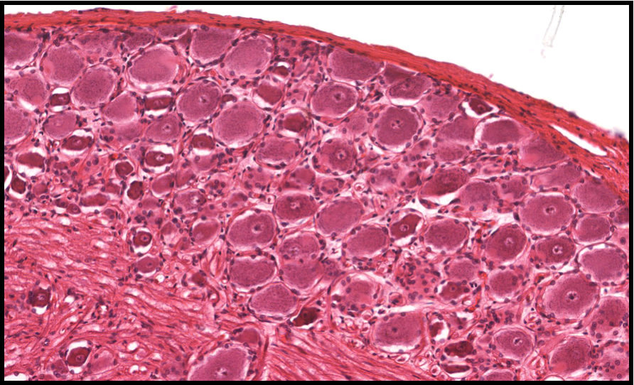 <p>examine this DRG</p><p>what are the types of cells? describe them</p>