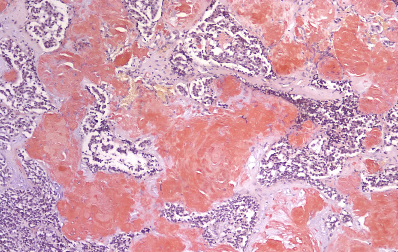 <p>ID the stain type </p>