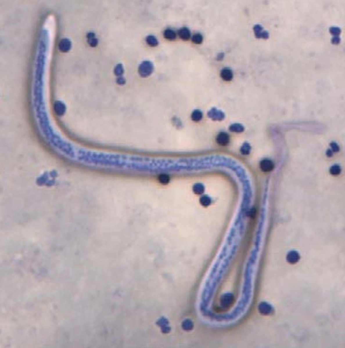 <p>d. Wuchereria bancrofti</p>