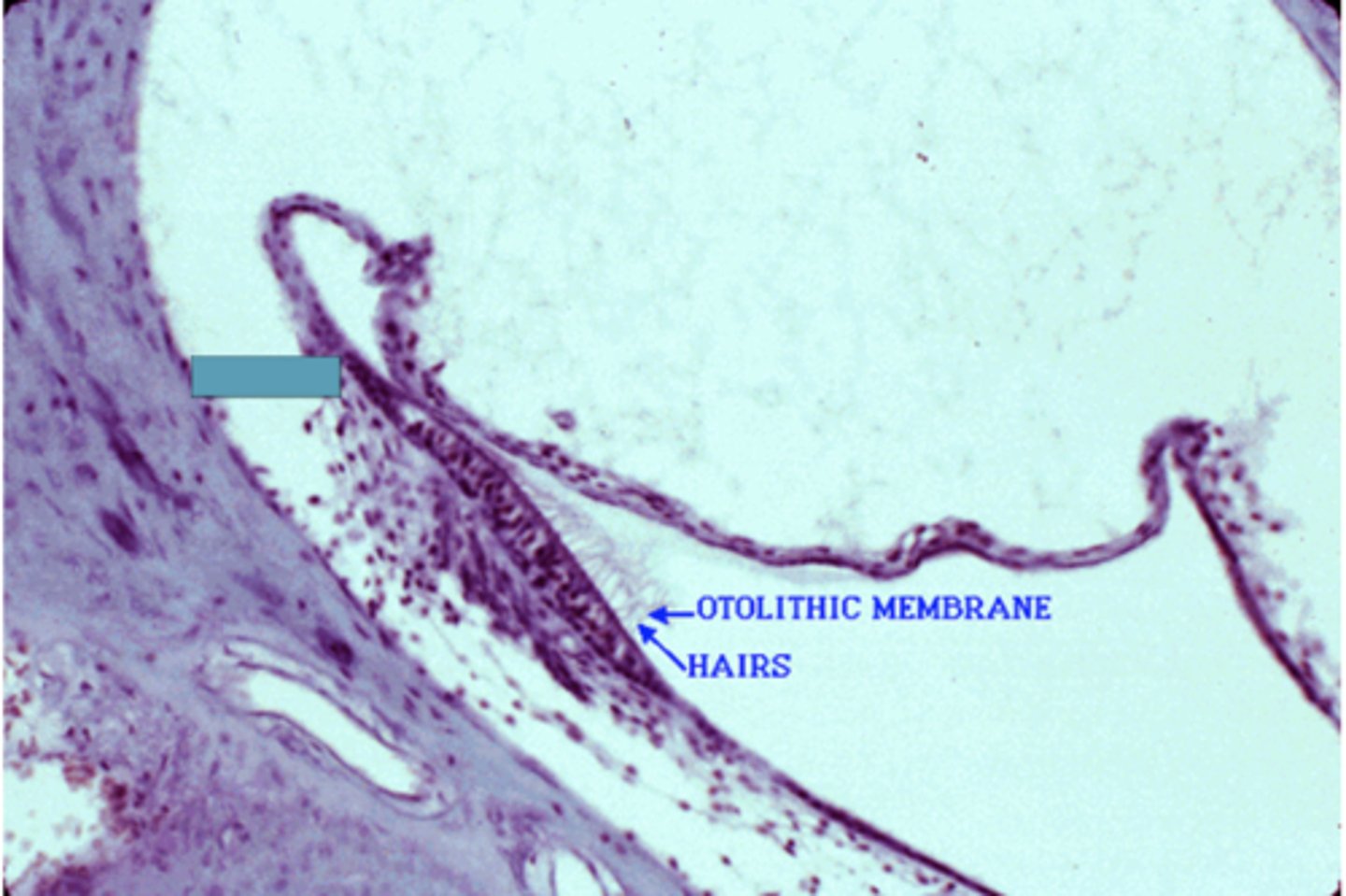 <p>Identify the following structure</p>