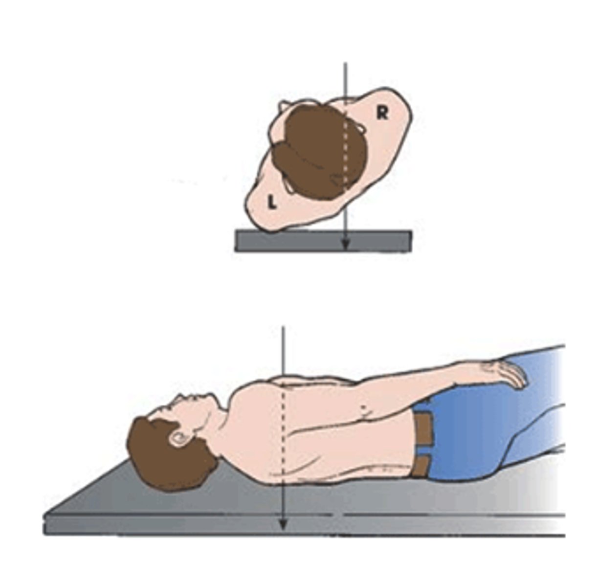 <p>Left Posterior Oblique</p>