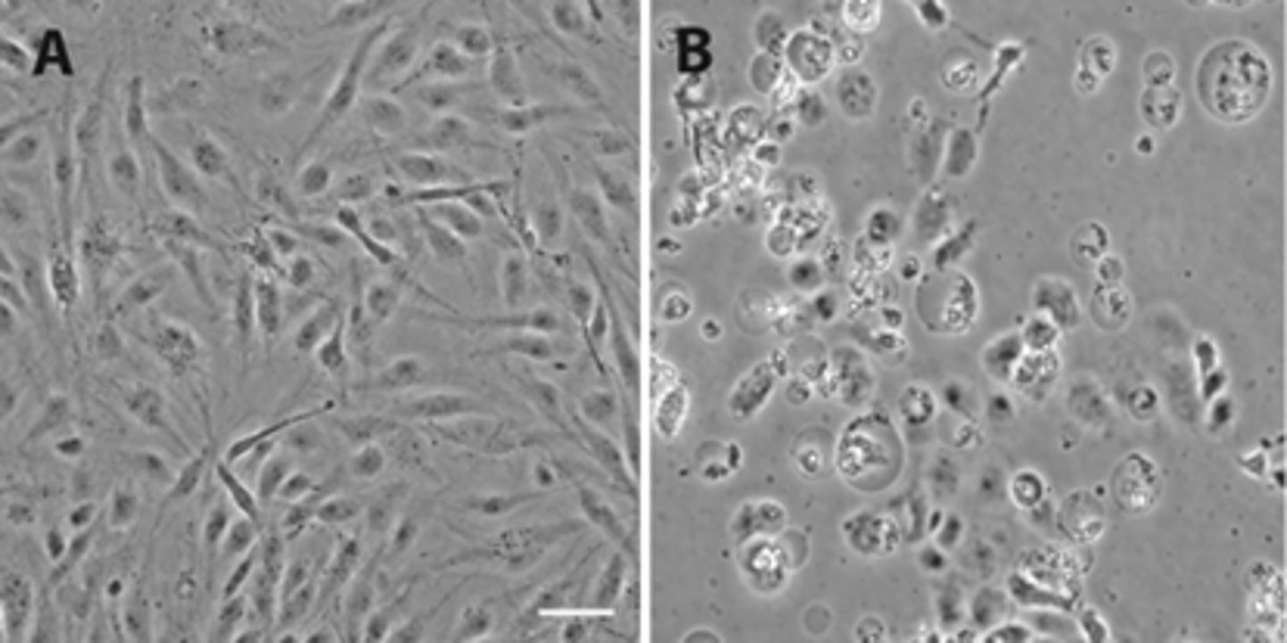 <p>infected cells bunch up and lyse when virus leaves the cell</p>