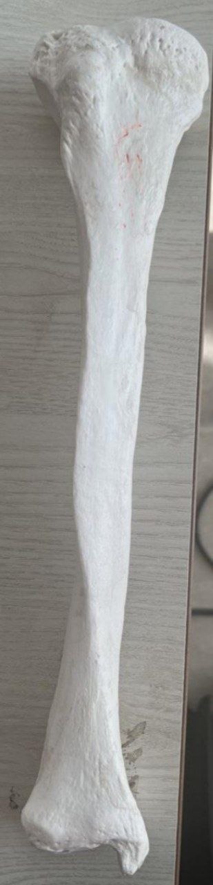 <p>Identify the bone and classify according to position and shape</p>