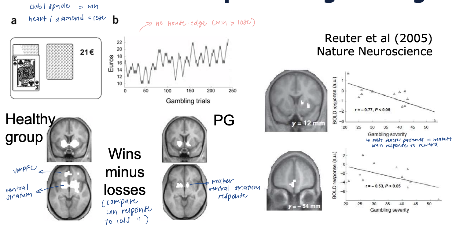 <p>task w no house-edge (win > lose) </p><ul><li><p>reduced striatum and vmPFC reward activity in PG → corr w gambling severity </p></li><li><p>most severe patients = weakest brain response to reward </p></li><li><p>supports reward deficiency hypothesis (underactive system) </p></li></ul><p></p>