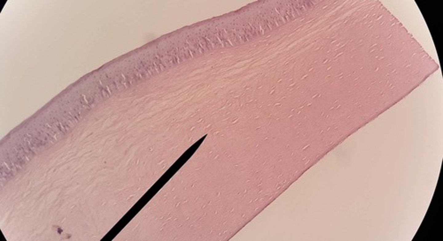 <p>Special: Vision</p><p>tissue structure located in the anterior aspect of the eyeball, anterior to the iris; its curved structure functions to focus light on the retina posteriorly; has three main layers: outer (nonkeratinized stratified squamous epithelium), middle "stroma" (collagen fibers and fibroblasts) and inner (simple squamous epithelium)</p>