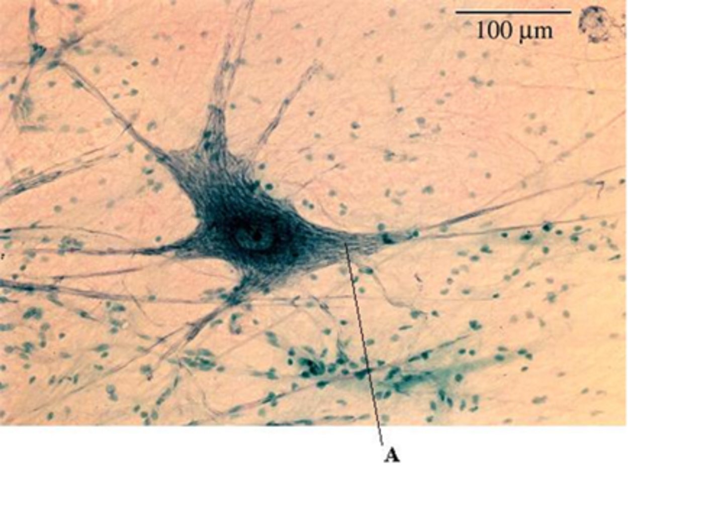 <p>A threadlike extension of a neuron that carries nerve impulses away from the cell body.</p>