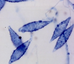 <p><span>Dermatophytosis</span></p>