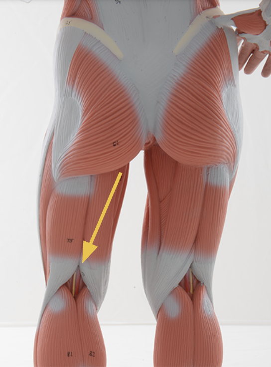 <p>semimembranosus m. </p><p><span>O: ischial tuberosity</span></p><p><span>I: medial condyle of tibia</span></p><p><span>Action(s): knee flexion, medial rotation of knee (when flexed), medial rotation of hip (when extended)</span></p><p><span>Innervated by tibial nerve</span></p>