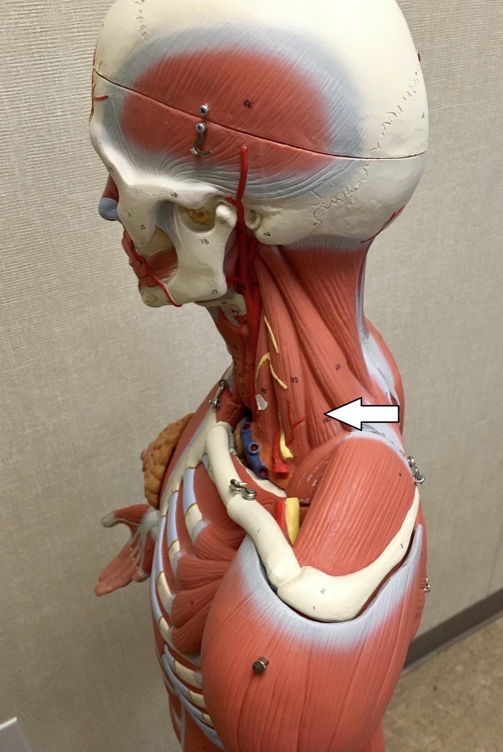 <p><span>Name the muscle labeled with the white arrow below AND name ONE action .</span></p>