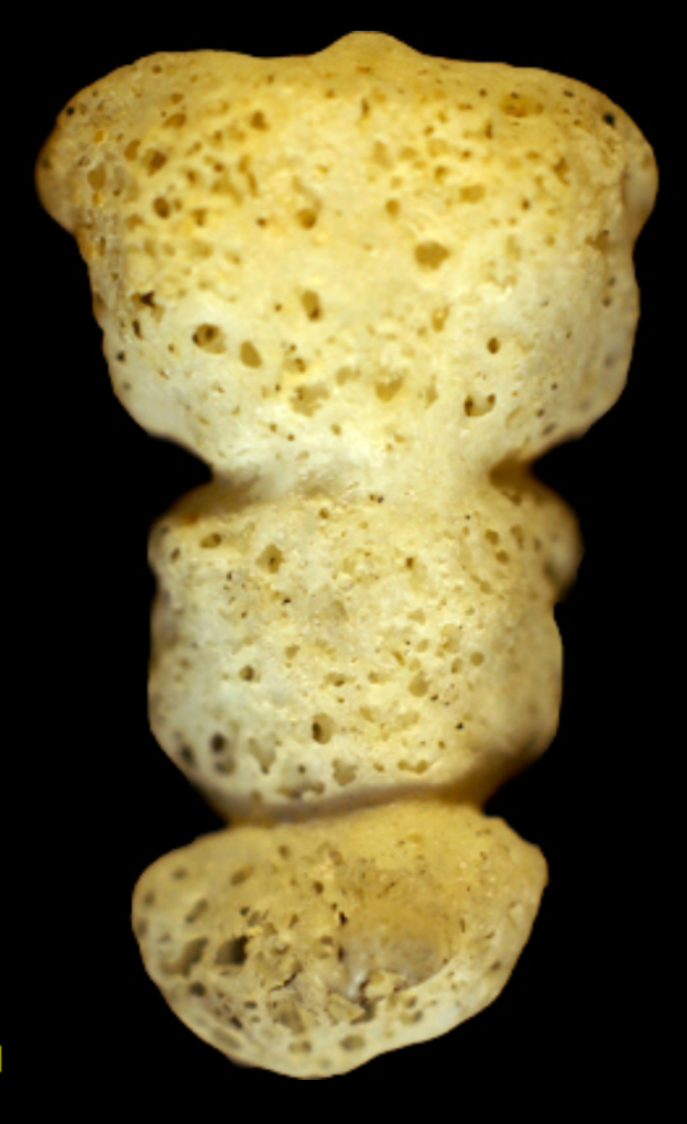 <p>What is this bone?</p>