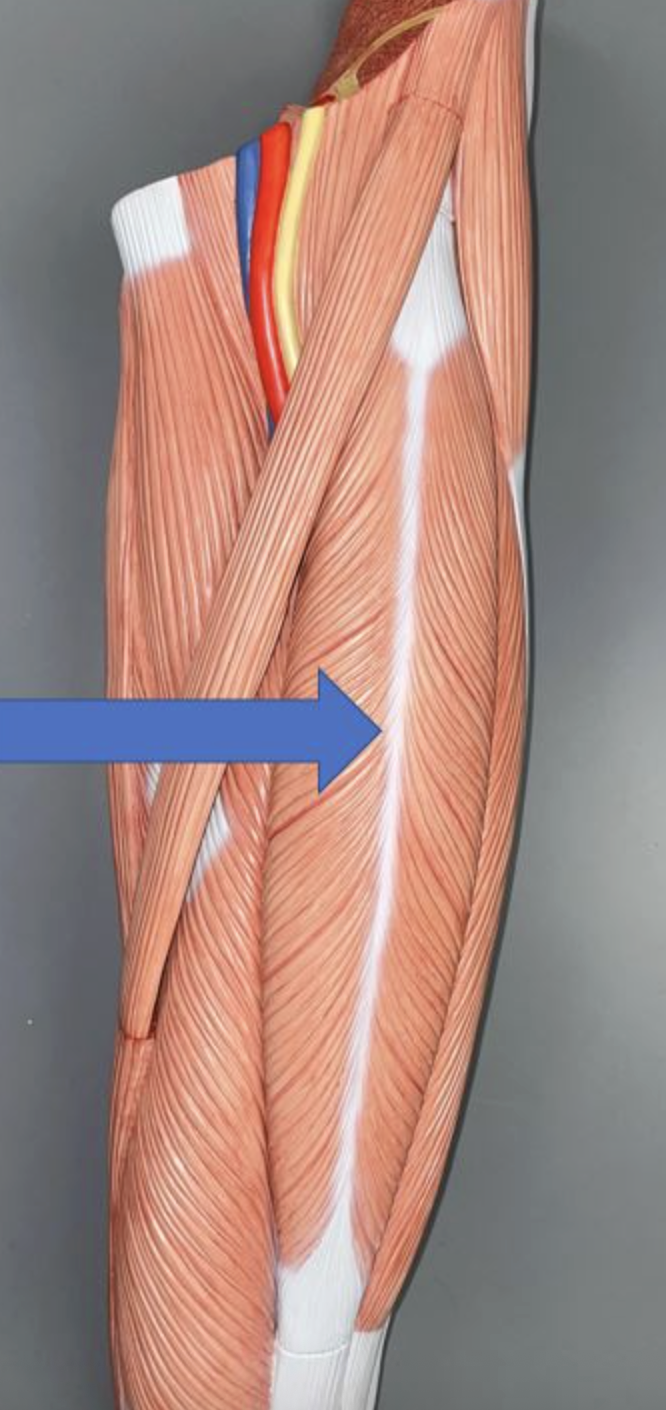 <p>muscle name &amp; action</p>