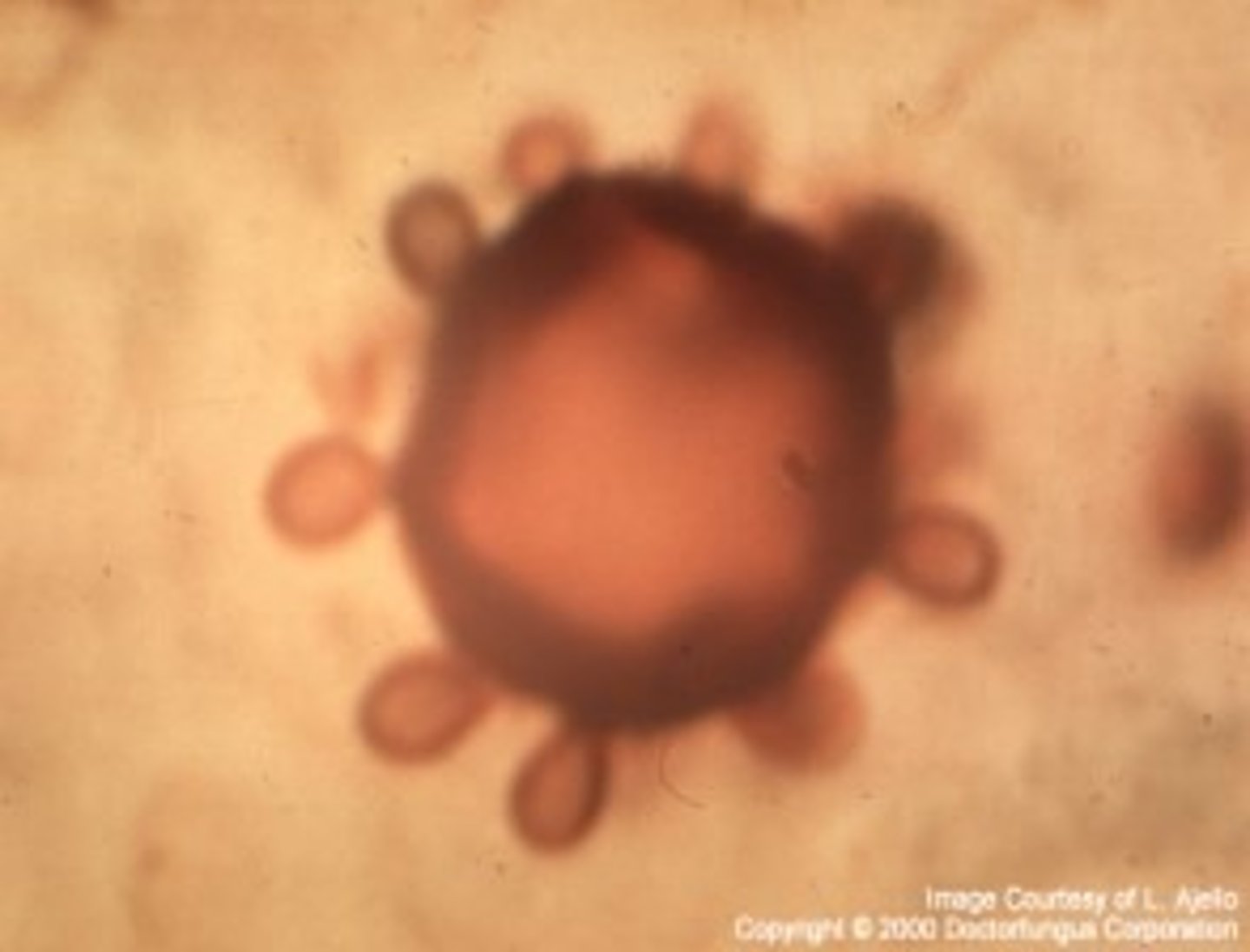 <p>(Yeast form)</p>