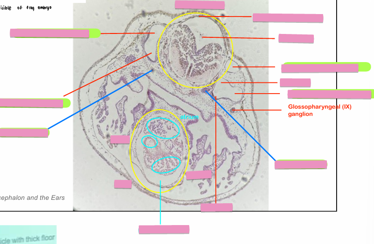 <p>what level<br>primary brain vesicle<br>parts</p>